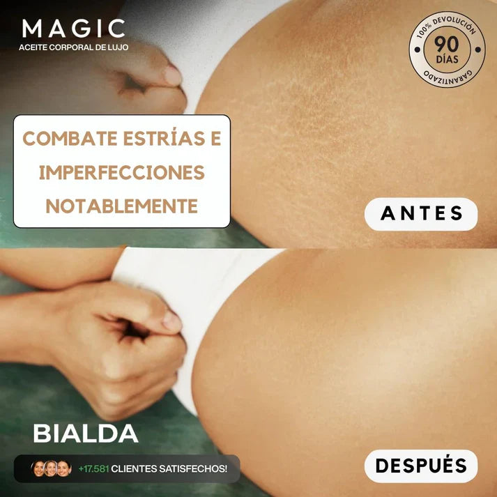 Magic Body Oil - Para estrías, flacidez y piel seca