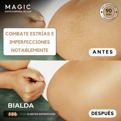 Magic Body Oil - Para estrías, flacidez y piel seca